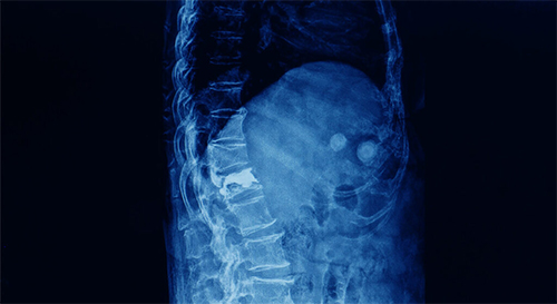 Non Vascular Interventions